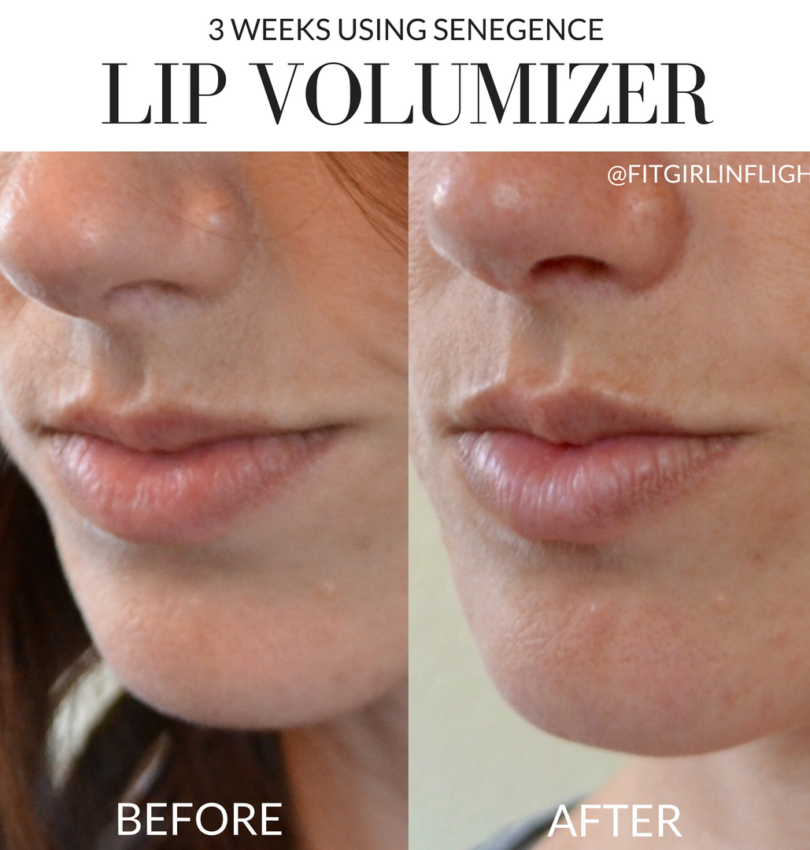 SeneDerm Lip Volumizer